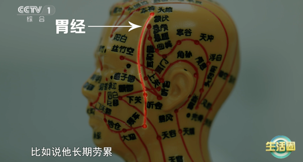 康问题 护发与健康小贴士快收藏开元棋牌不同位置白发反映不同健(图3)